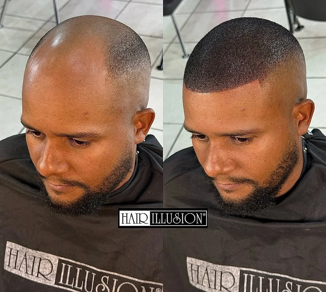 Before and after 5