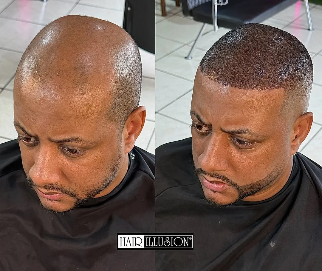 Before and after 2